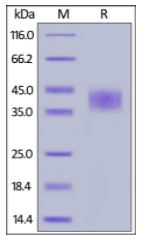 Human CD48, His Tag on SDS-PAGE under reducing (R) condition. The gel was stained overnight with Coomassie Blue. The purity of the protein is greater than 95%.